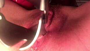 Cervix Stretched And Sounded With Deep Insertion