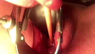 Cervix Stretched And Sounded With Deep Insertion