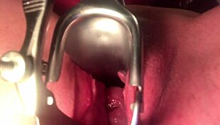 Cervix Stretched And Sounded With Deep Insertion