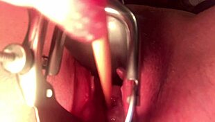 Cervix Stretched And Sounded With Deep Insertion