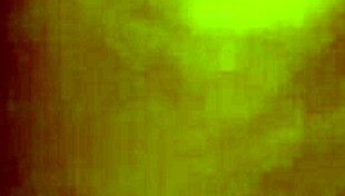 Uncle Gently Touches My Hairy Area