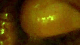 Uncle Gently Touches My Hairy Area