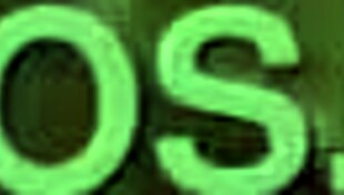 Best Sperm Compilation With Twink Couples And Cumshots