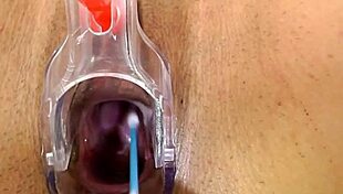 Lily's gynecological examination videos in high definition