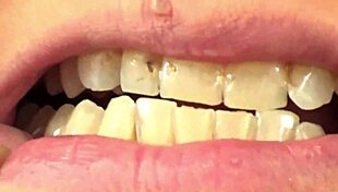 Watch fifi foxx's mouth vore close up eating gummy bears