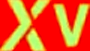 Patient's Intense Anal Relaxation with Brazilian Doctor in Hospital