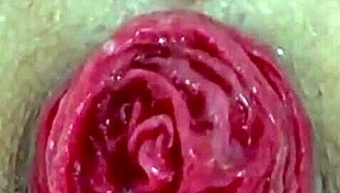 Destroyed Anal Juicy Prolapse Asshole Close Up Play With Extreme Emotions