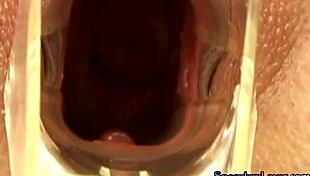 Speculum Babe Dildo Fucks Before Showing Insides