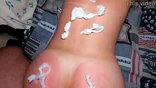 Stepsister Sunburn Relief Turns Intense Doggystyle Fuck