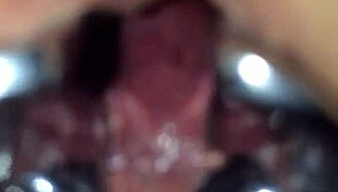 shemale speculum stretches my ass wide open